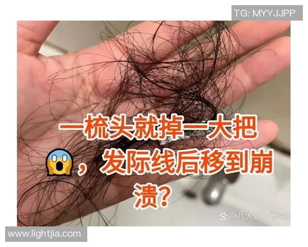 足球球星脱发困扰揭秘 从发际线到球场表现的背后秘密 足球球星脱发困扰揭秘 从发际线到球场表现的背后秘密